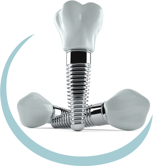 Dental Implant